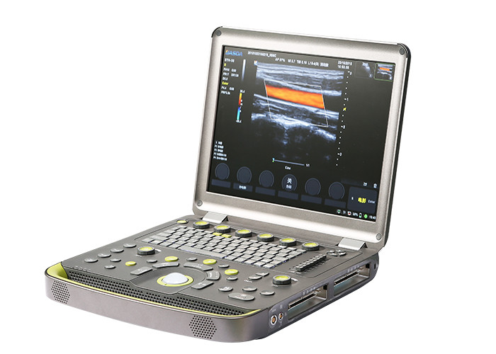 Buy cheap 3D Color Doppler Laptop Ultrasound Scanner Triplex Synchronous Trapezoidal Imaging product