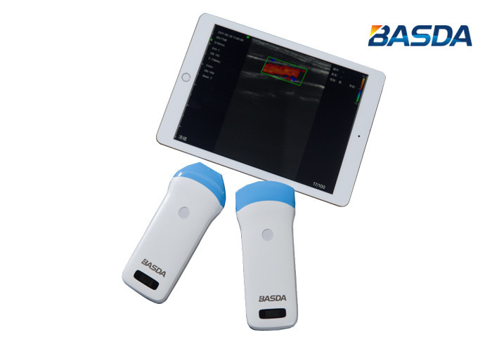 Buy cheap WIFI Connect Medical Ultrasound Machine product