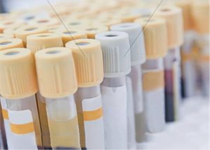 Buy cheap PS Material Blood Sample Collection Tubes , D308-4 Blood Test Tube product