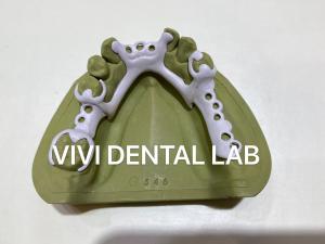 China CAD CAM PEEK Partial Denture Framework 3Shape Exocad Denture Design on sale