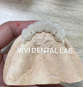 Buy cheap Zirconia Dental Attachment Partial Denture Stable CAD CAM ISO Approved product