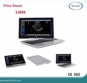 China Price Down notice Laptop ultrasound scanner on sale