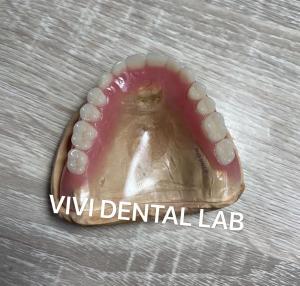 China Removable Clear Full Acrylic Denture Retentive Natural Looking on sale