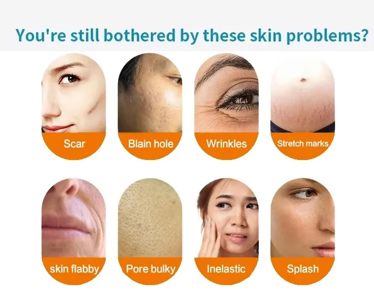Facial Shrinking Pores Wrinkles Removal Microcrystalline RF Beauty Machine