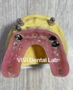 Buy cheap CAD CAM Tooth Partial Denture Attachment Dental Professional Accurate product