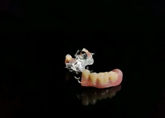 Flexible Metal Framework Partial Dentures Expertly Designed Removable Dental