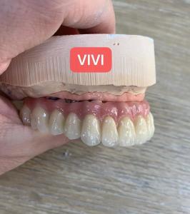 China ISO Esthetic Dental Implant Crown Precise Bridge Tooth Implant on sale