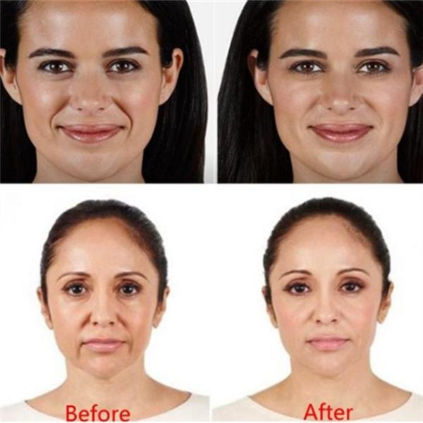 CE Hyaluronic Acid Injectable Filler 1ml / Box For Face