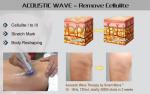 Shock wave therapy equipment Medical EDSWT for Vasculogenic and diabetic ED
