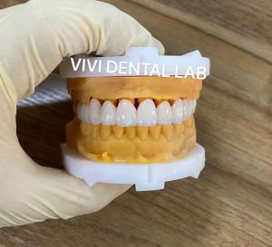 Buy cheap CE Dental Tooth Crowns Nickel Beryllium Free VIVI Dental Laboratory product