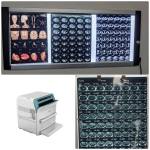 China Blue Medical X Ray Films Compatible Fuji Drypix  Lyte 2000 3500 Printer DIHT 8X10 For DR CT MRI Image on sale