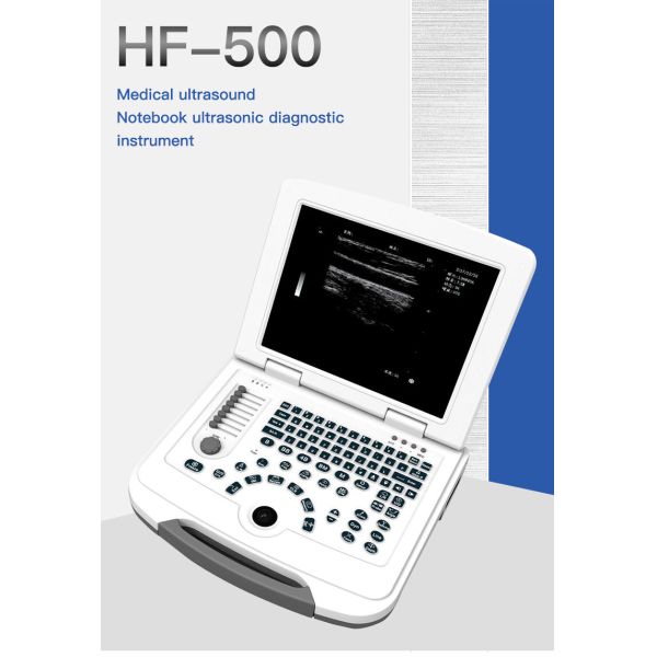 250mm Depth LED Display Medical Ultrasound Scanner