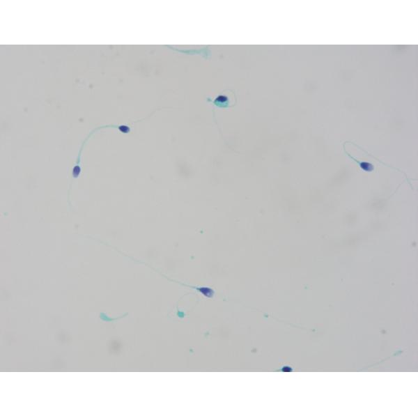 Sperm (Cell) Morphological Stain Solution Shorr Method 4×100mL 4×500mL