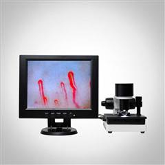 China LCD Display Health Analyzer Machine Clinical Blood Analysis Microcirculation Microscope on sale