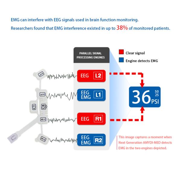 6 Electrodes Disposable Eeg Sensor Non Invasive Eeg Brain Sensor With Masim Modules Monitors