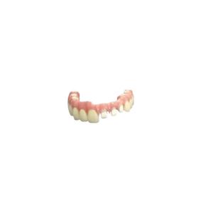 China Flexible Individual Titanium Removable Dental Crown For Dental Clinic on sale