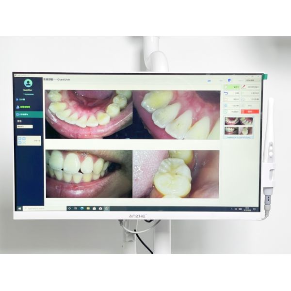 4 Universal Wheels Cold Light Teeth Whitening System Butterfly Shape Teeth Bleaching Equipment
